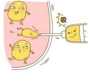 吸脂減肥手術(shù)要注意哪些風(fēng)險問題