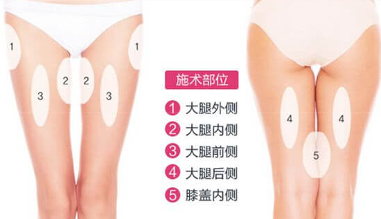 吸脂減肥 能減掉多少脂肪