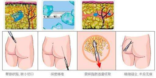 怎么樣減肥效果明顯且速度快