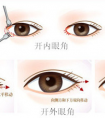 做開眼角手術(shù)的風險大不大