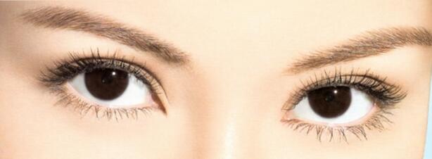 開眼角失敗了還能恢復嗎