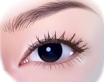 做開眼角手術(shù)會出現(xiàn)疤痕嗎