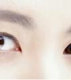 做開眼角手術(shù)會出現(xiàn)疤痕嗎