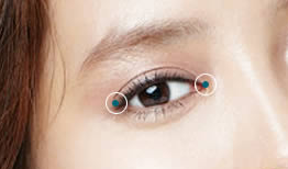 每個人都能開眼角嗎