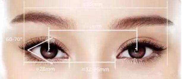 近視眼可以做開眼角手術(shù)嗎