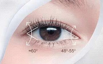 開眼角常見的后遺癥主要有哪些