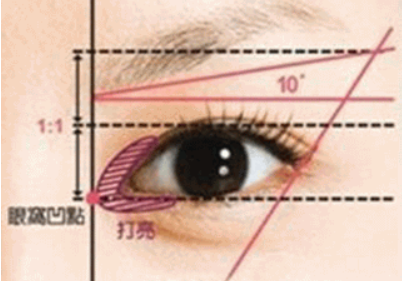 開(kāi)眼角的價(jià)格受哪些因素影響