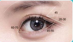 近視眼可以開眼角嗎