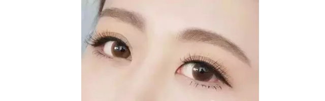 做雙眼皮手術(shù)要花多少錢