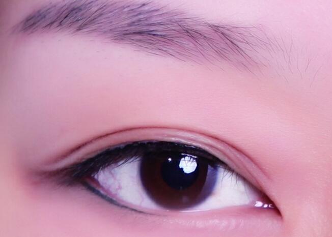 割個雙眼皮要花多少錢