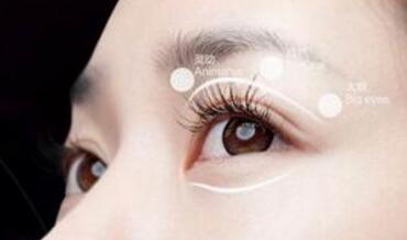 做雙眼皮手術后能戴眼鏡嗎