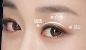 全切雙眼皮的效果能長久維持嗎