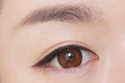 祛眼袋手術要用多少錢