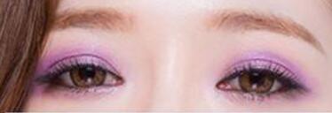 雙眼皮助你輕松擺脫單眼皮小眼睛