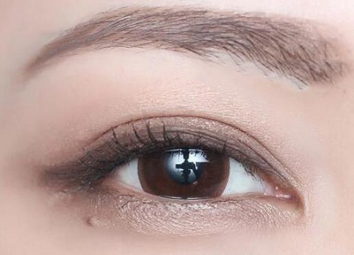 全切雙眼皮的疤痕要怎么處理