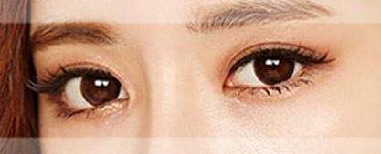 雙眼皮手術后怎么恢復比較快