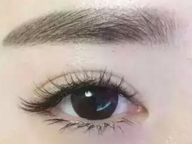 雙眼皮手術對眼睛視力有影響嗎