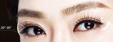 雙眼皮手術(shù)的價(jià)格受什么因素影響