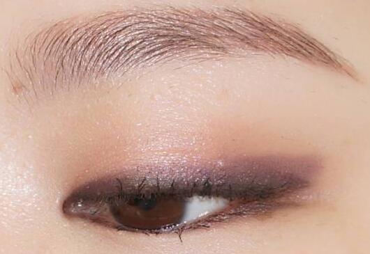 雙眼皮手術(shù)失敗會有什么癥狀