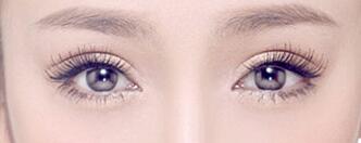 割雙眼皮有疤痕怎么辦