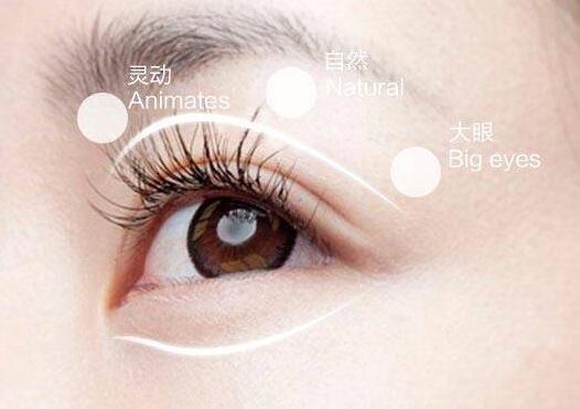 雙眼皮手術(shù)失敗了還能修復(fù)補(bǔ)救嗎