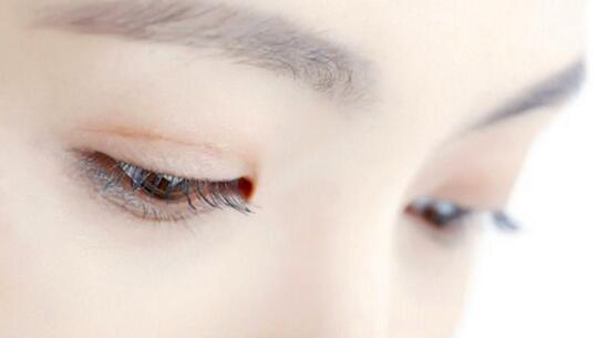 埋線雙眼皮效果能維持多少年