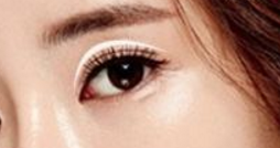 做個雙眼皮安不安全