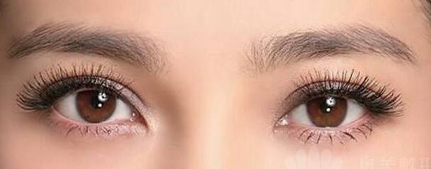 做雙眼皮手術(shù)會(huì)不會(huì)影響視力