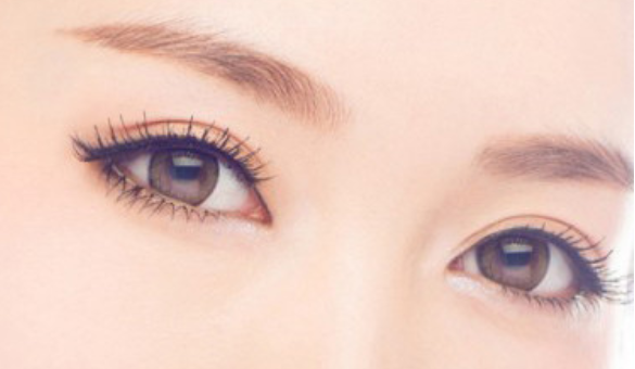 雙眼皮形狀有幾種類型