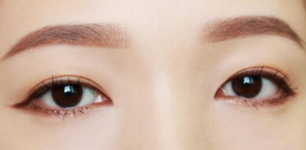 雙眼皮術(shù)后需要做好的護(hù)理事項