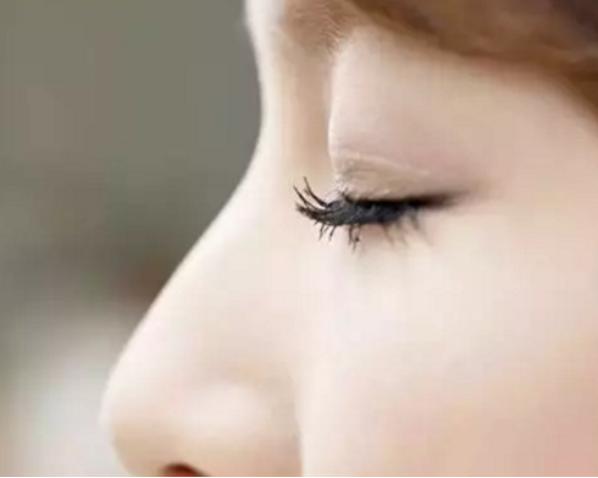 割雙眼皮后效果可以保持多久