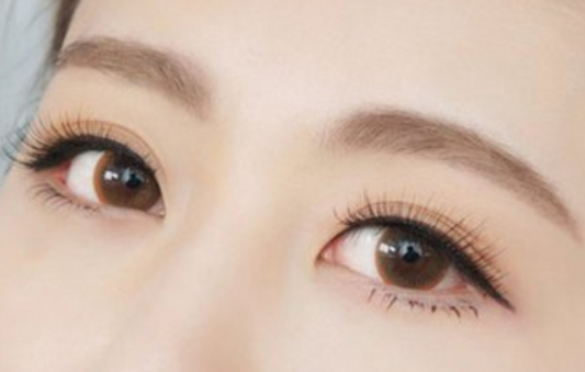 廣州切開雙眼皮的費(fèi)用是多少