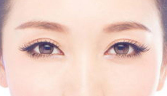 廣州切開雙眼皮的費(fèi)用是多少