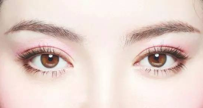 切開雙眼皮有哪些優(yōu)勢