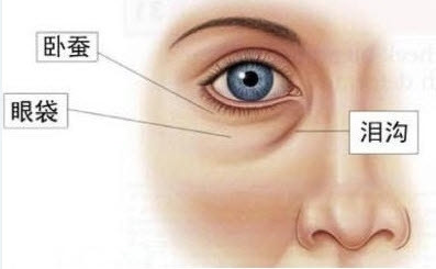 做眼袋手術(shù)多少錢