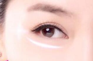 在廣州做祛眼袋手術(shù)要多少錢