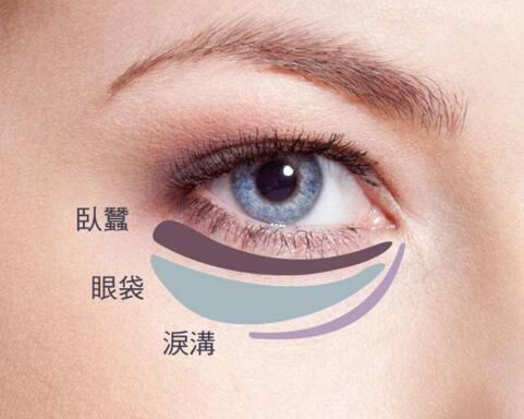 手術(shù)切除眼袋會有風(fēng)險嗎