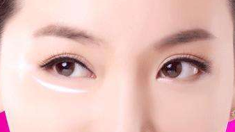 手術(shù)切除眼袋的價格貴不貴