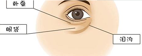 手術(shù)切除眼袋要多久恢復好