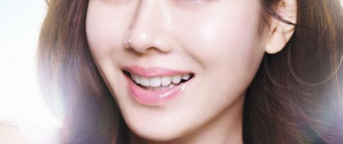 自體脂肪豐蘋果肌的高嗎