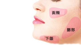 在廣州做面部脂肪填充的價格是多少