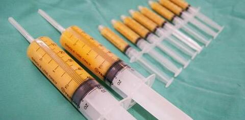 面部脂肪填充的價格是多少