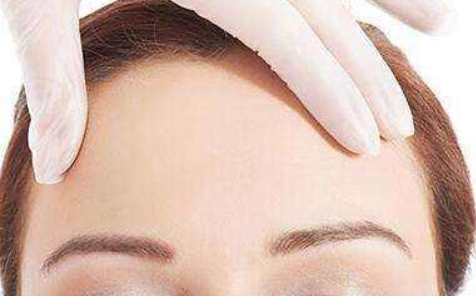 自體脂肪填充要注射幾次