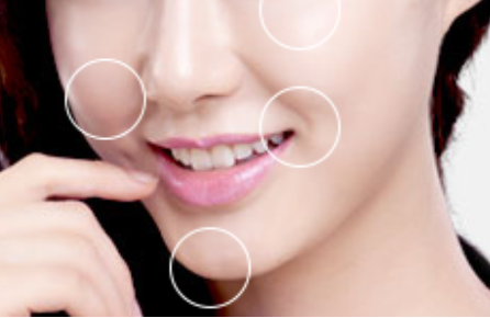 自體脂肪填充面部需要多少錢