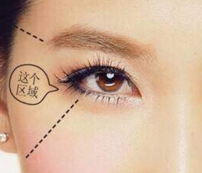 自體脂肪填充臉部需要多少錢