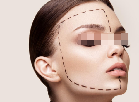 自體脂肪填充臉部會(huì)有風(fēng)險(xiǎn)嗎