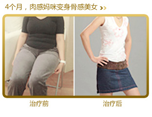 美萊中醫(yī)健康減肥案例-肉感媽媽變身骨感美女