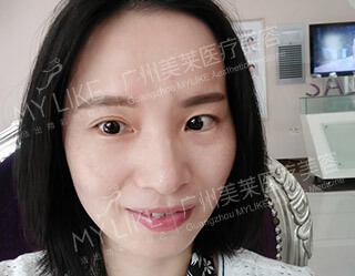 一個療程 ― 正面