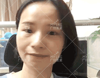 一個療程 ― 45°