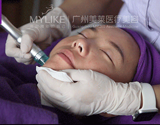 雙皮秒專業(yè)凈斑亮膚治療 （蜂巢皮秒+Picoway超皮秒）